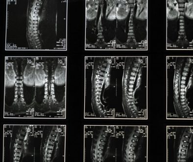 spinal images